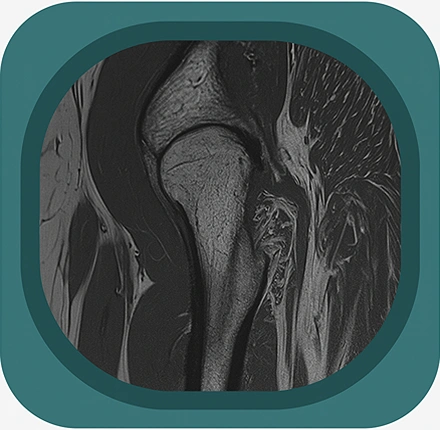 MRI hip ligaments anatomy icon